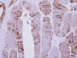 Invitrogen COLQ Polyclonal Antibody 100 &mu;L; Unconjugated:Antibodies,