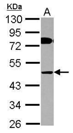 Invitrogen COLQ Polyclonal Antibody 100 &mu;L; Unconjugated:Antibodies,