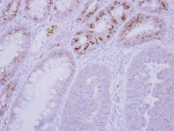 Invitrogen GCKR Polyclonal Antibody 100 &mu;L; Unconjugated:Antibodies,