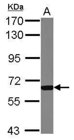 Invitrogen GCKR Polyclonal Antibody 100 &mu;L; Unconjugated:Antibodies,