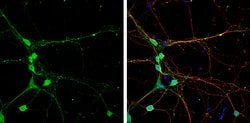 Invitrogen CLIP1 Polyclonal Antibody 100 &mu;L; Unconjugated:Antibodies,