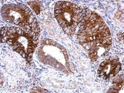 Invitrogen GPS2 Polyclonal Antibody 100 &mu;L; Unconjugated:Antibodies,