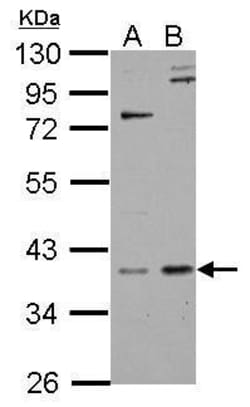 Invitrogen GPS2 Polyclonal Antibody 100 &mu;L; Unconjugated:Antibodies,