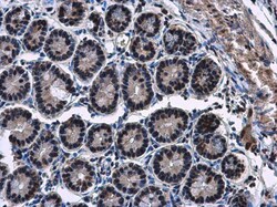 Invitrogen HP1 gamma Polyclonal Antibody 100 &mu;L | Buy Online | Invitrogen&trade; | Fisher Scientific