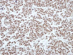 Invitrogen HP1 gamma Polyclonal Antibody 100 &mu;L | Buy Online | Invitrogen&trade; | Fisher Scientific