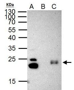 Invitrogen HP1 gamma Polyclonal Antibody 100 &mu;L | Buy Online | Invitrogen&trade; | Fisher Scientific