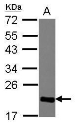 Invitrogen HP1 gamma Polyclonal Antibody 100 &mu;L | Buy Online | Invitrogen&trade; | Fisher Scientific