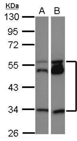 Invitrogen MEIS2 Polyclonal Antibody 100 &mu;L; Unconjugated:Antibodies,