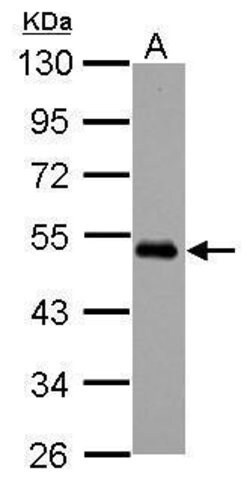 Invitrogen MEIS2 Polyclonal Antibody 100 &mu;L; Unconjugated:Antibodies,