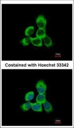 Invitrogen Cytoglobin Polyclonal Antibody 100 &mu;L; Unconjugated:Antibodies,