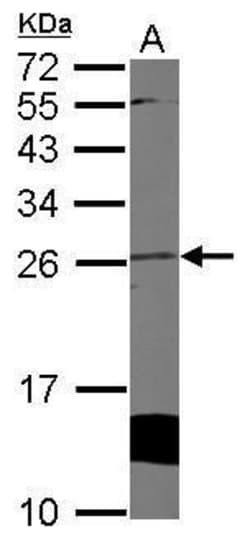 Invitrogen Cytoglobin Polyclonal Antibody 100 &mu;L; Unconjugated:Antibodies,