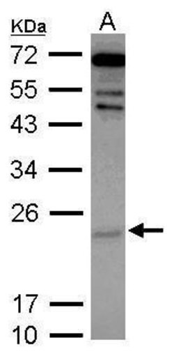 Invitrogen Cytoglobin Polyclonal Antibody 100 &mu;L; Unconjugated:Antibodies,