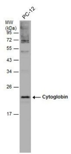 Invitrogen Cytoglobin Polyclonal Antibody 100 &mu;L; Unconjugated:Antibodies,