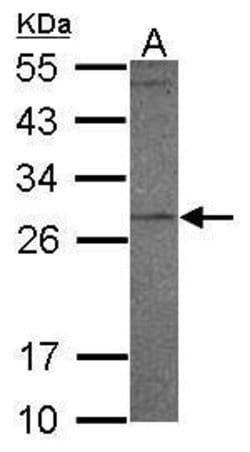 Invitrogen PR3 Polyclonal Antibody 100 &mu;L; Unconjugated:Antibodies,
