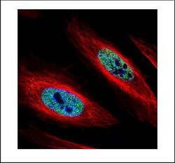 Invitrogen hnRNP A2B1 Polyclonal Antibody 100 &mu;L; Unconjugated:Antibodies,