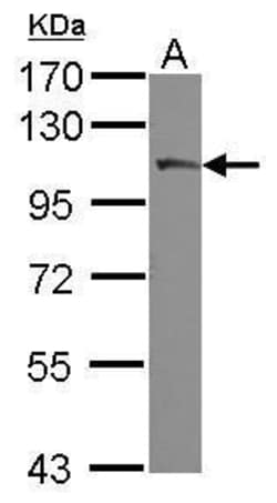 Invitrogen PLA2G4A Polyclonal Antibody 100 &mu;L; Unconjugated:Antibodies,