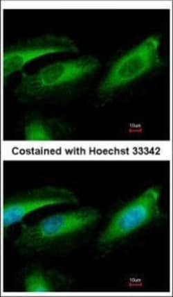 Invitrogen Pirh2 Polyclonal Antibody 100 &mu;L; Unconjugated:Antibodies,