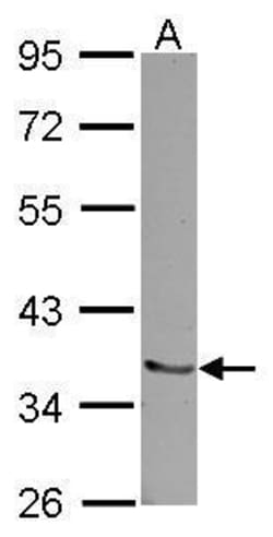 Invitrogen Pirh2 Polyclonal Antibody 100 &mu;L; Unconjugated:Antibodies,