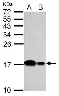 Invitrogen UBE2D2 Polyclonal Antibody 100 &mu;L; Unconjugated:Antibodies,