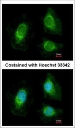 Invitrogen RRP4 Polyclonal Antibody 100 &mu;L; Unconjugated:Antibodies,
