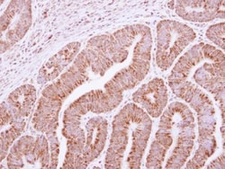 Invitrogen RRP4 Polyclonal Antibody 100 &mu;L; Unconjugated:Antibodies,