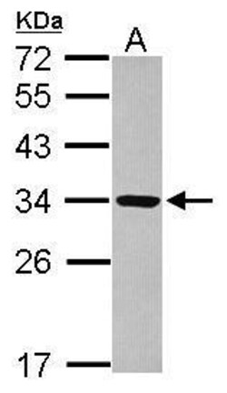 Invitrogen RRP4 Polyclonal Antibody 100 &mu;L; Unconjugated:Antibodies,