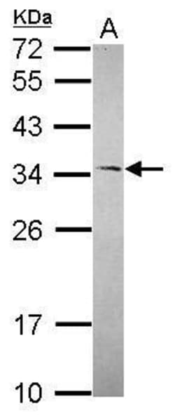 Invitrogen RNaseH1 Polyclonal Antibody 100 &mu;L; Unconjugated:Antibodies,