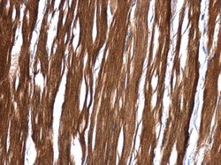 MRRF Polyclonal Antibody, Invitrogen™