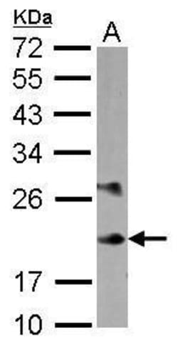 Invitrogen MYL6B Polyclonal Antibody 100 &mu;L; Unconjugated:Antibodies,