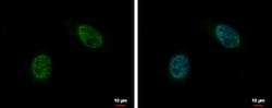 Invitrogen C10orf4 Polyclonal Antibody 100 &mu;L; Unconjugated:Antibodies,