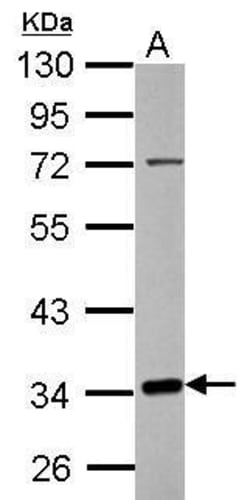 Invitrogen C10orf4 Polyclonal Antibody 100 &mu;L; Unconjugated:Antibodies,