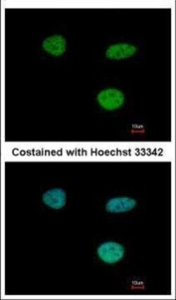 Invitrogen IFI35 Polyclonal Antibody 100 &mu;L; Unconjugated:Anticuerpos
