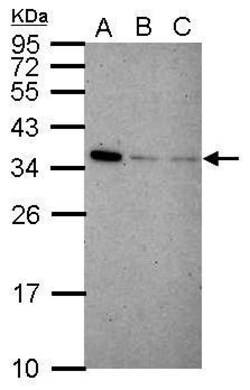 Invitrogen IFI35 Polyclonal Antibody 100 &mu;L; Unconjugated:Anticuerpos