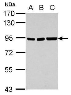 Invitrogen ZNF31 Polyclonal Antibody 100 &mu;L | Buy Online | Invitrogen&trade; | Fisher Scientific