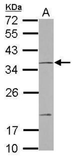 Invitrogen NOTCH2NL Polyclonal Antibody 100 &mu;L | Buy Online | Invitrogen&trade; | Fisher Scientific
