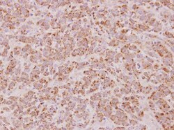 Invitrogen PSMB7 Polyclonal Antibody 100 &mu;L; Unconjugated:Antibodies,