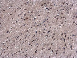 Invitrogen PSMB7 Polyclonal Antibody 100 &mu;L; Unconjugated:Antibodies,