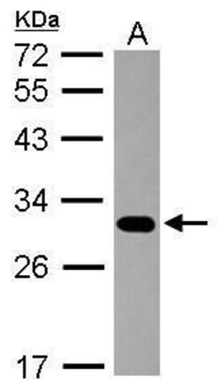Invitrogen PSMB7 Polyclonal Antibody 100 &mu;L; Unconjugated:Antibodies,