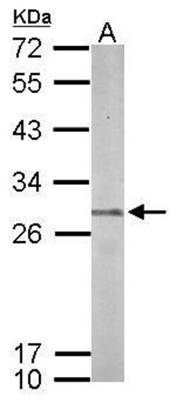 Invitrogen PSMB7 Polyclonal Antibody 100 &mu;L; Unconjugated:Antibodies,