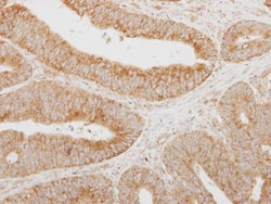 Invitrogen SERPINA12 Polyclonal Antibody 100 &mu;L; Unconjugated:Antibodies,