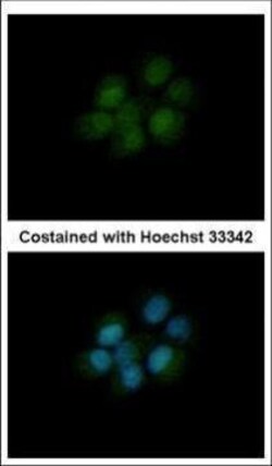Invitrogen DHFR Polyclonal Antibody 100 &mu;L; Unconjugated:Antibodies,