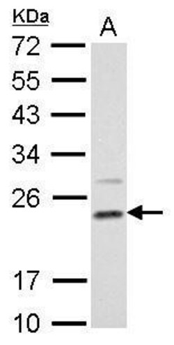 Invitrogen DHFR Polyclonal Antibody 100 &mu;L; Unconjugated:Antibodies,
