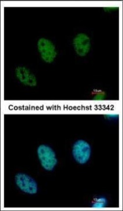 Invitrogen CDYL Polyclonal Antibody 100 &mu;L | Buy Online | Invitrogen&trade; | Fisher Scientific