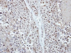 Invitrogen CDYL Polyclonal Antibody 100 &mu;L; Unconjugated:Antibodies,