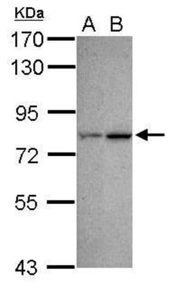 Invitrogen CDYL Polyclonal Antibody 100 &mu;L; Unconjugated:Antibodies,