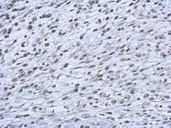 Invitrogen CBX2 Polyclonal Antibody 100 &mu;L; Unconjugated:Antibodies,