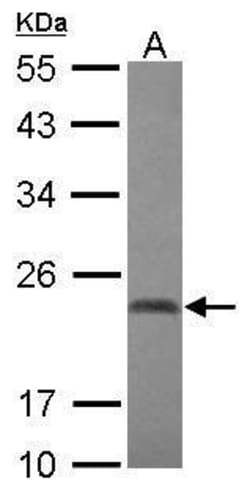Invitrogen CBX2 Polyclonal Antibody 100 &mu;L; Unconjugated:Antibodies,