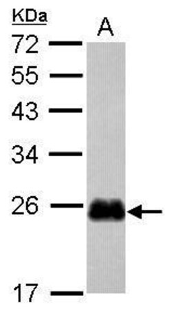 Invitrogen CRIP2 Polyclonal Antibody 100 μL; Unconjugated:Antibodies,
