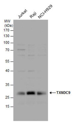 Invitrogen TXNDC9 Polyclonal Antibody 100 &mu;L | Buy Online | Invitrogen&trade; | Fisher Scientific