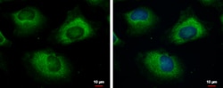 Invitrogen UBC3B Polyclonal Antibody 100 &mu;L; Unconjugated:Antibodies,